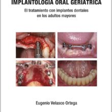 Implantología Oral Geriátrica.