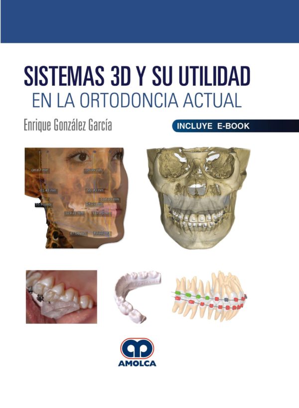 Sistemas 3D y su Utilidad en la Ortodoncia Actual
