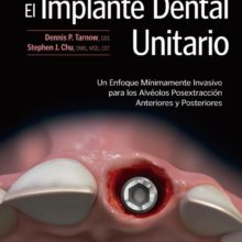 El Implante Dental Unitario.