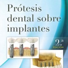 Prótesis Dental sobre Implantes