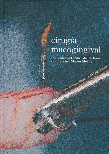 Cirugía Mucogingival