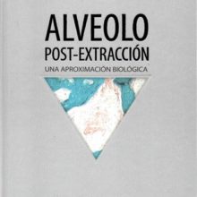 Alveolo Post-Extracción