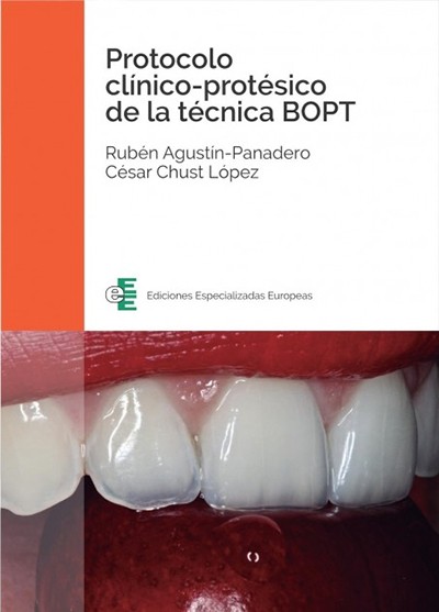 Protocolo Clínico-Protésico de la Técnica BOPT