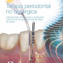 Terapia periodontal no quirúrgica