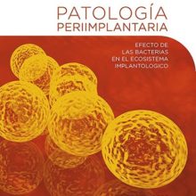 Patología Periimplantaria
