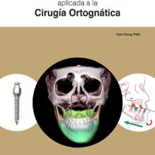 Microimplantes en Ortodoncia aplicada a la Cirugía Ortognática