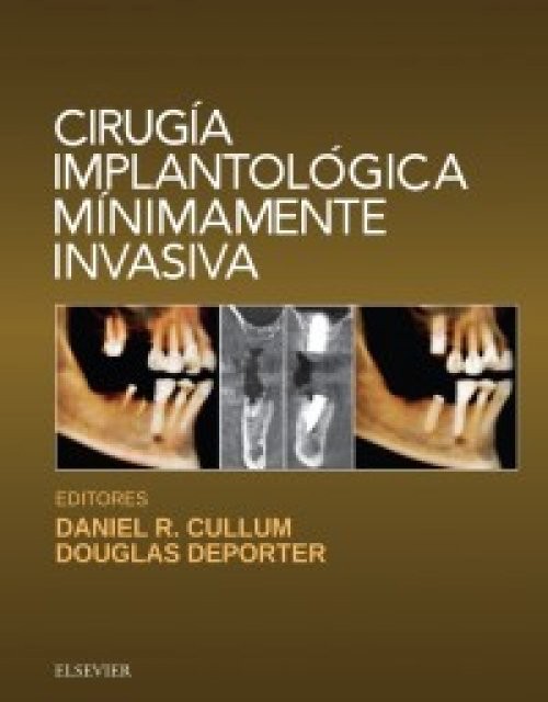 Cirugía Implantológica Minimamente Invasiva