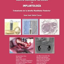 Clínica y Cirugía del Nervio Dentario Inferior en Implantología.