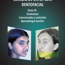 Manual de Ortopedia Dentofacial. Tomo III. Síndromes transversales y verticales. Aparatología Auxiliar