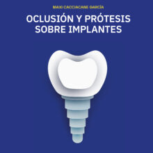 Oclusión y Prótesis sobre Implantes