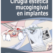 Cirugía Estética Mucogingival en Implantes (2 Vol.)