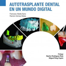 Autotrasplante dental en un mundo digital